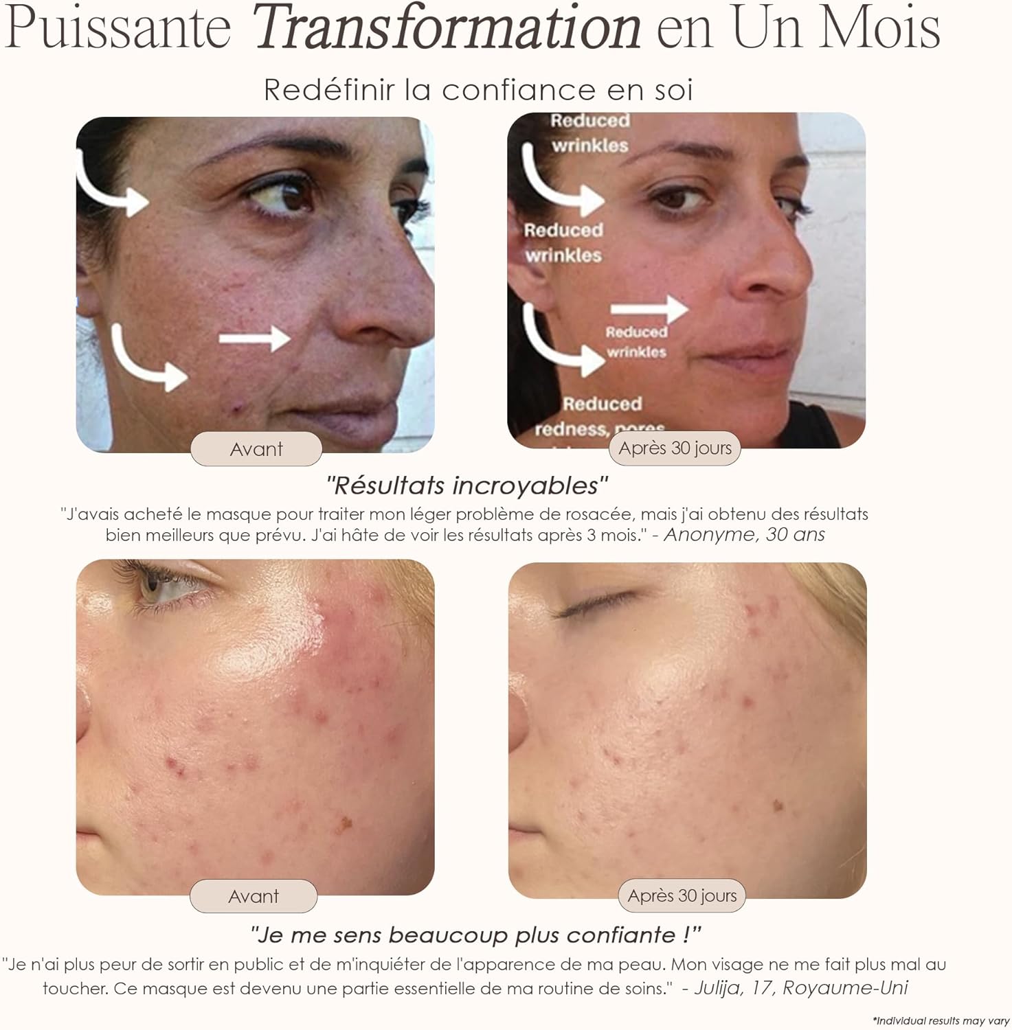 Project E Beauty Skin Rejuvenation Photonic Device 7 Colors LED Photon Light Therapy Treatment Whitening AntiAgeing Smooth Lines Facial Device - Image 3