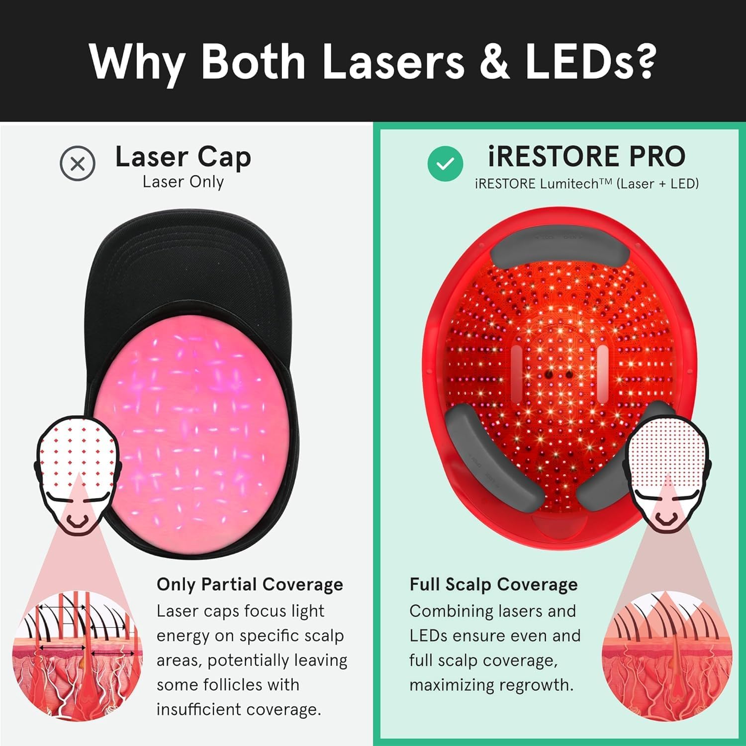 iRestore Professional FDA Cleared Laser Hair Growth Device Red Light Therapy for Thinning Hair Receding Hairline Balding Laser Cap for Men Women DrugFree Hair Loss Treatment - Image 2